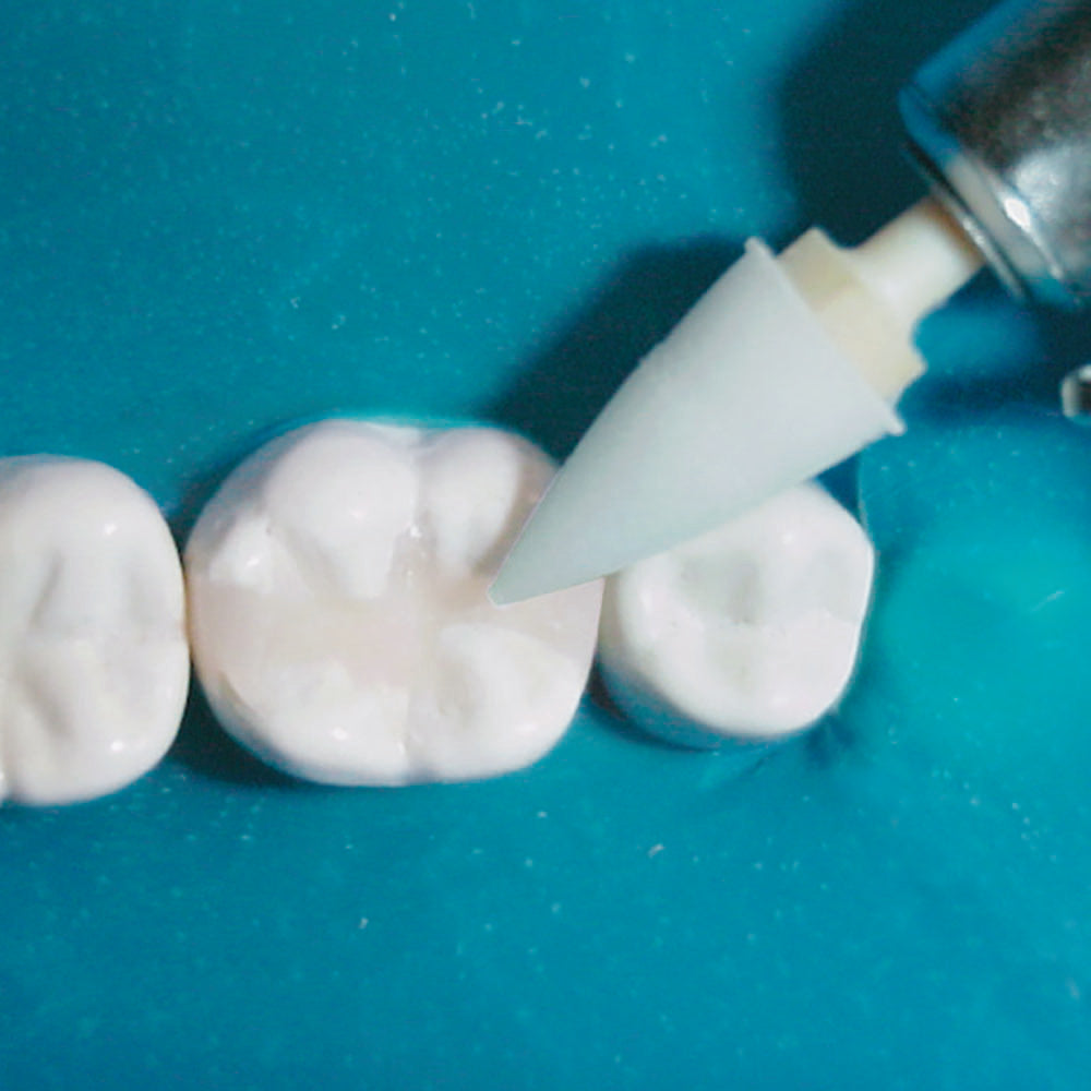 Kit de Pulido Optimize 24un TDV