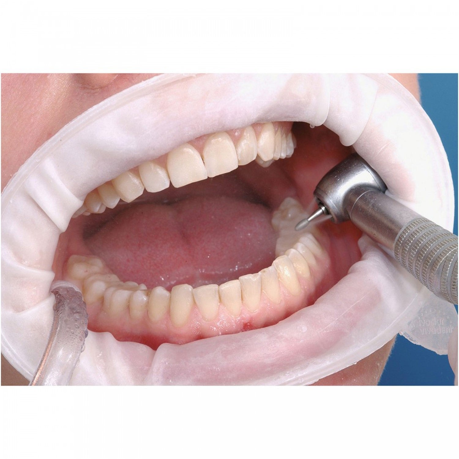 Separador labial Abreboca sin latex OptraGate Ivoclar Vivadent