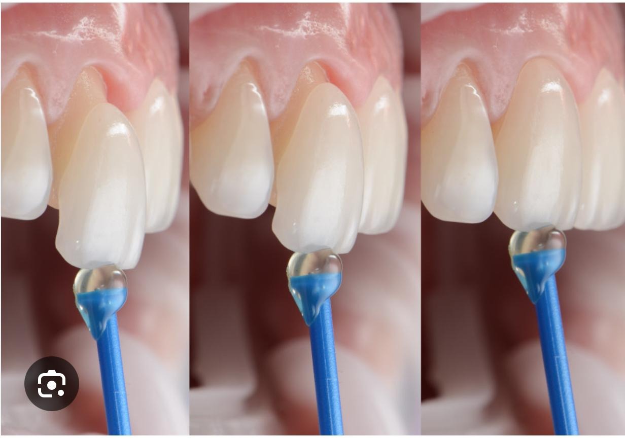 Valustick Tips Aplicadores Punta Silicona 20un