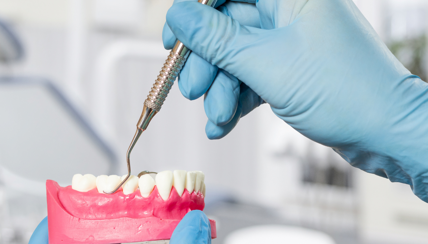 Las curetas periodontales: fundamento, clasificación, uso clínico y consideraciones para su afilado