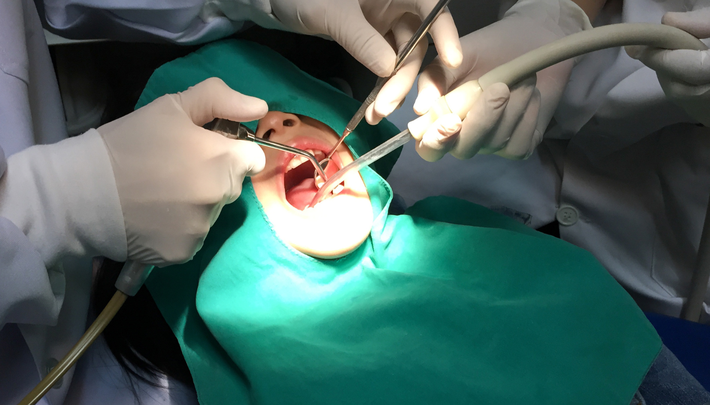 Domina los elevadores dentales: la diferencia entre una exodoncia común y una quirúrgicamente impecable