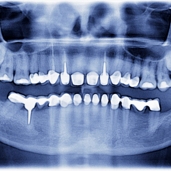 Radiología dental