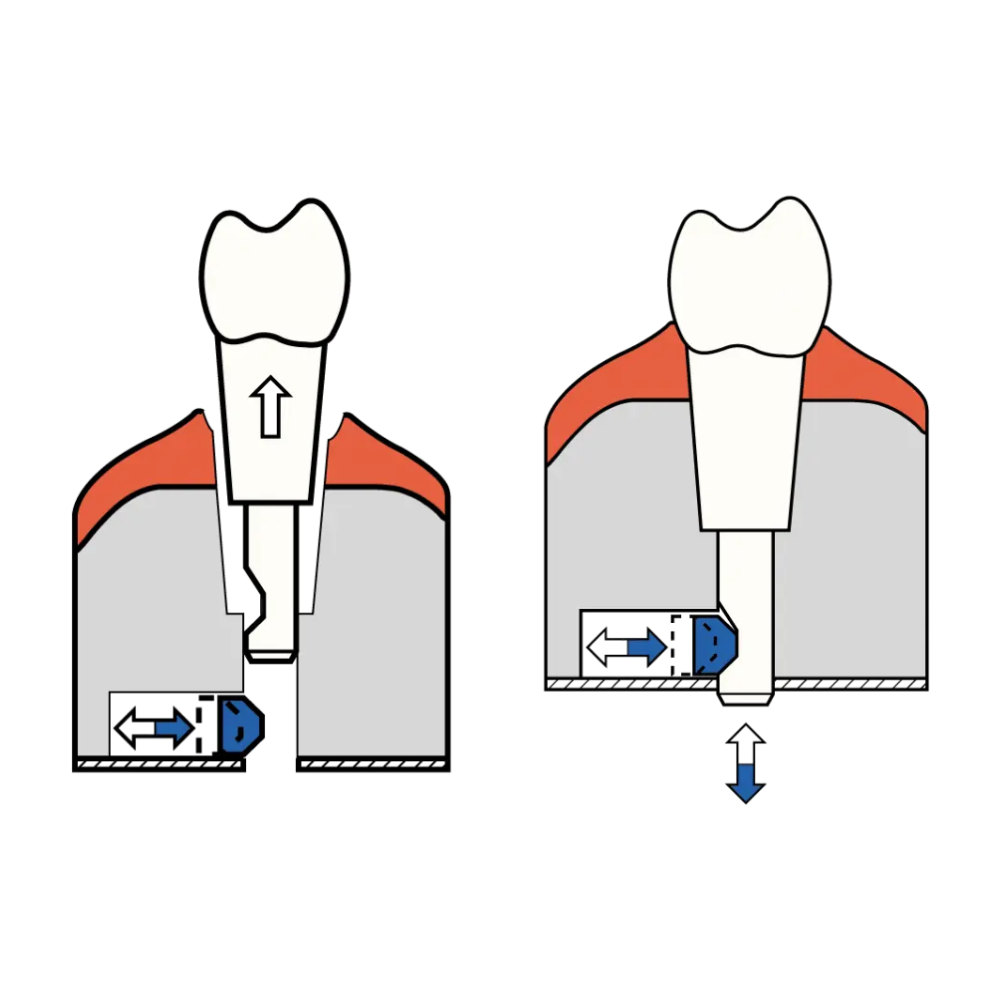 Modelos Dentales Arcada Superior e Inferior KaVo