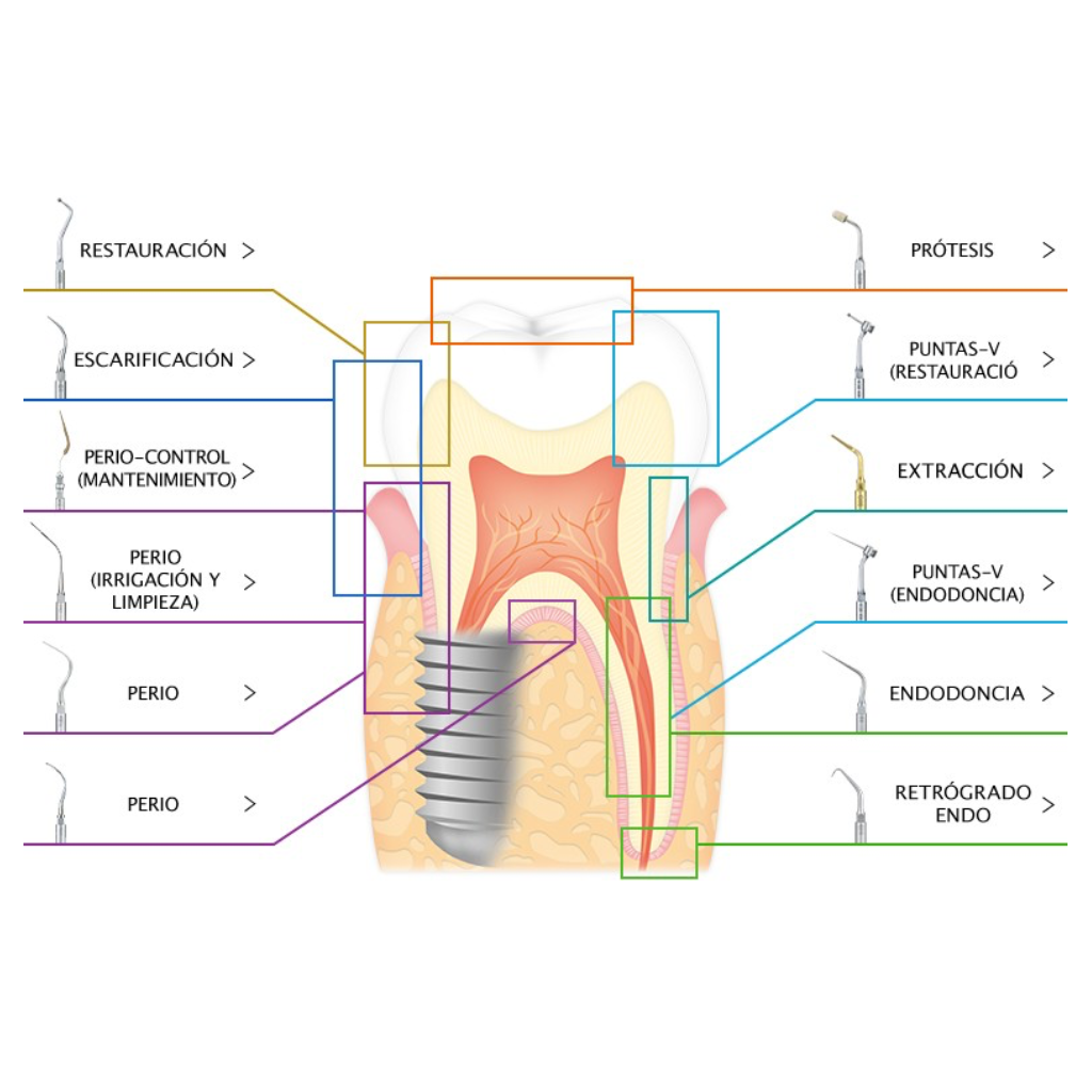 Punta de Ultrasonido G1 Escarificación NSK - eksadental