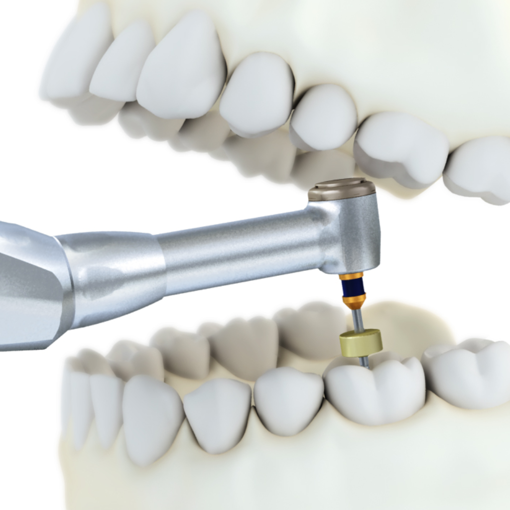 Endo-Mate TC2 Motor de Endodoncia inalámbrico NSK - eksadental